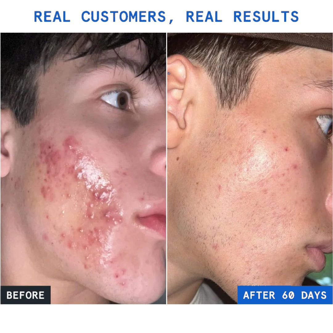 GHK-Cu Peptides Serum TryDeloura GHK-Cu Peptides Serum TryDeloura