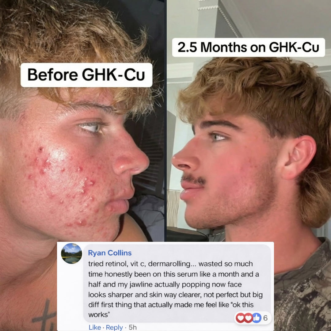 GHK-Cu Peptides Serum TryDeloura GHK-Cu Peptides Serum TryDeloura